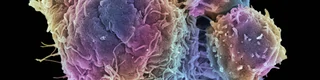 Immunogenicity Risk Assessment | Immunotoxicity Assessment