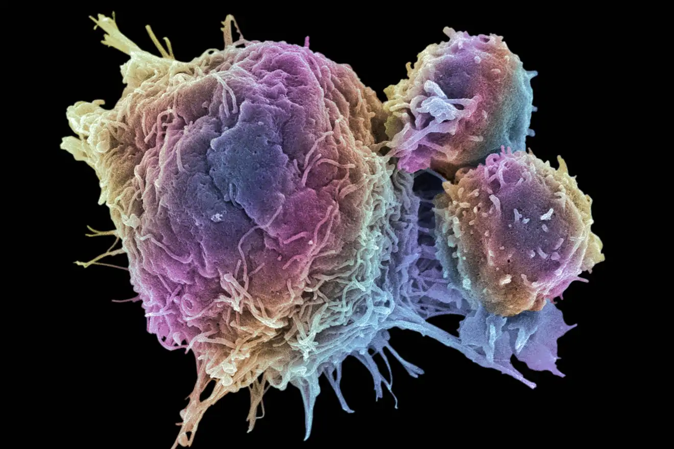Cancer Cell and T Lymphocytes