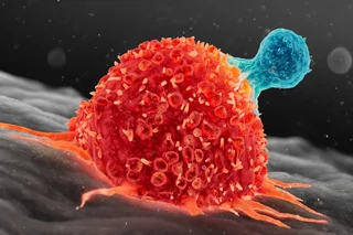 Defining the Next Generation of Immune-oncology Cell Therapy