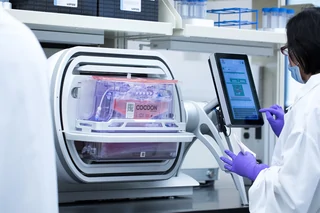 Automated T Cell Therapy Manufacturing in the Cocoon® Platform