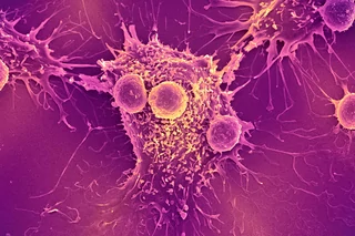 Transparent Communication Supports Tech Transfers of Cis-targeted Immunotherapies